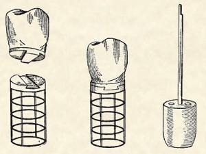 Implante dental antiguo